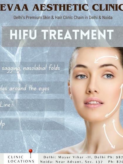 This visual guide points out the specific concerns HIFU addresses, including facial sagging, nasolabial folds, wrinkles around the eyes, and improving the overall face line with a lift-up effect.