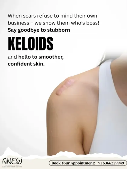 When scars refuse to mind their own business, we show them who's boss. Our advanced treatments for keloids are designed to effectively flatten and reduce these stubborn scars, giving you smoother, more confident skin.