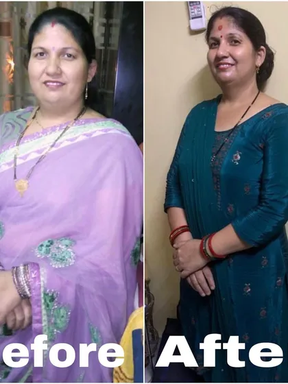 Another inspiring before and after from a dedicated client. You can see the clear difference not just in her weight, but in her confidence and smile. This is what happens when you decide to prioritize your health.