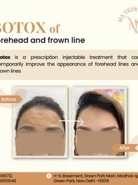 Anti-Aging & Facial Contouring