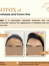 Anti-Aging & Facial Contouring
