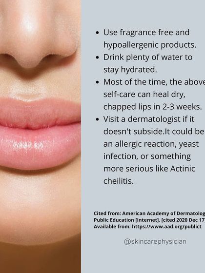 With the right self-care, chapped lips often heal in 2-3 weeks. If the problem persists, it's important to see a dermatologist to rule out other issues like an allergic reaction or infection.