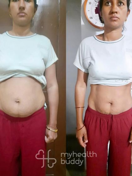 This mom of two toddlers was dealing with belly fat, fatty liver, and Diastasis Recti. Through a simple plan of home food and consistent exercise, she took control of her health and saw incredible changes in just 3 months.