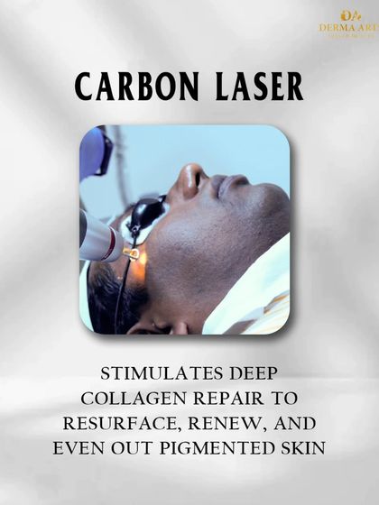 Our Carbon Laser stimulates deep collagen repair to resurface, renew, and even out pigmented skin, making it an excellent choice for overall rejuvenation.