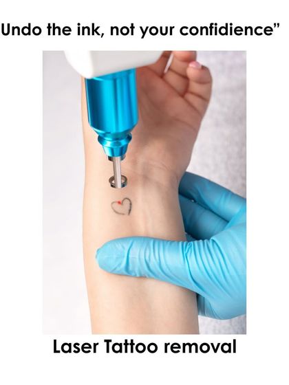 I believe in helping you undo the ink without undoing your confidence. This image shows the precise application of the laser during a tattoo removal session for a small, delicate tattoo on the wrist.