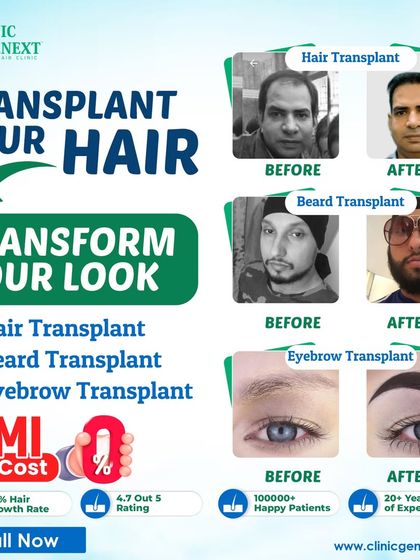 I offer permanent restoration for more than just scalp hair. This graphic shows successful before-and-after results for scalp hair, beard, and eyebrow transplants.