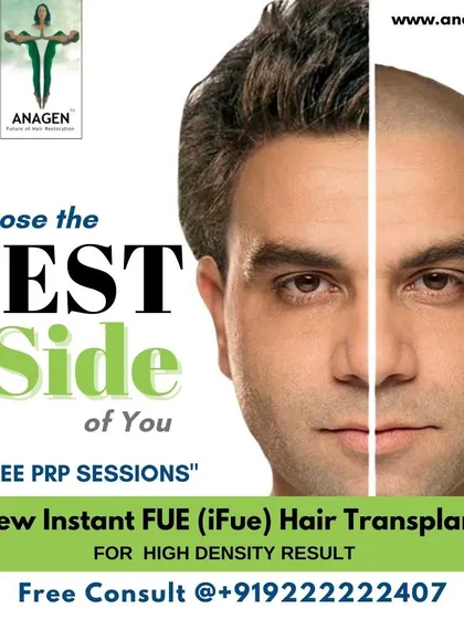 You have the power to choose the best version of yourself. Our advanced hair restoration, including our New Instant FUE technique, delivers high density results that can completely change your look. We even offer complimentary PRP sessions to support your journey.