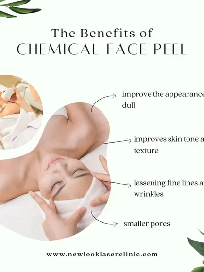 A chemical face peel is an excellent option for total skin rejuvenation. As shown here, it improves dullness, refines skin tone and texture, lessens fine lines, and helps reduce the appearance of pores.