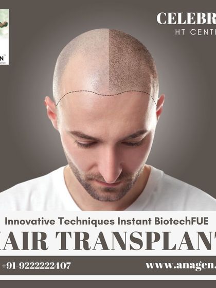 We are a celebrity hair transplant center offering innovative techniques like Instant BiotechFUE. We focus on creating natural, artistic hairlines that are tailored to your face shape.