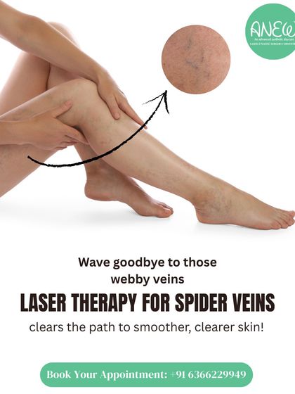 Wave goodbye to those webby spider veins. Our targeted laser therapy clears the path to smoother, clearer skin by gently fading visible veins on the legs, face, and body without harming surrounding tissue.