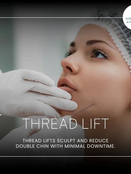 A thread lift is a minimally invasive option that can sculpt the jawline and reduce a double chin. The threads provide an immediate lift while also stimulating collagen production over time.