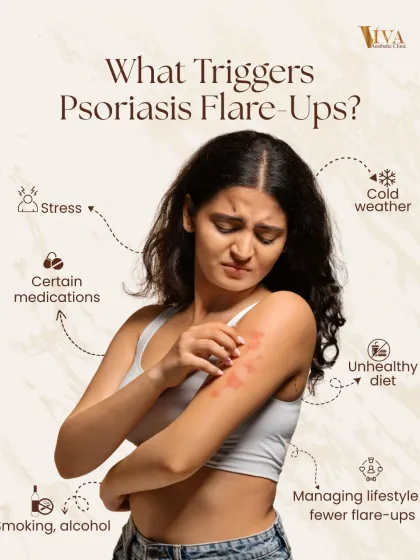 Understanding what triggers your psoriasis is key to managing it. This infographic outlines common triggers like stress, cold weather, certain medications, an unhealthy diet, and smoking. Managing your lifestyle can lead to fewer flare-ups.