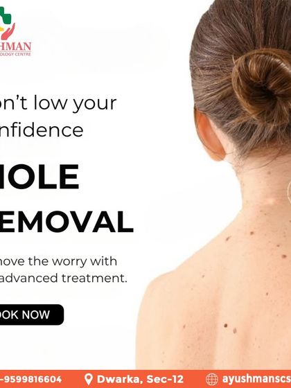 Don't let a mole lower your confidence. I offer advanced mole removal treatments to remove the worry and help you achieve smoother, clearer skin.