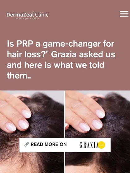 My expertise in PRP as a game-changer for hair loss was featured in Grazia magazine. This recognition highlights my commitment to using effective, science-backed treatments to help my patients regain their confidence.