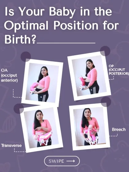 Is your baby in the optimal position for birth? This series explains the different fetal positions, from the ideal Occiput Anterior (OA) to breech and transverse.