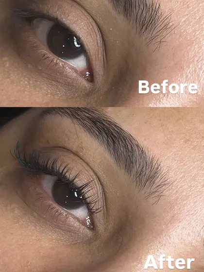 A simple before and after that shows the subtle yet powerful impact of well-applied lash extensions. We focused on adding length and a gentle curl to lift the eyes, creating a beautiful, natural enhancement. This is our classic lash extension style.