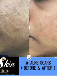 Cosmetic Dermatology