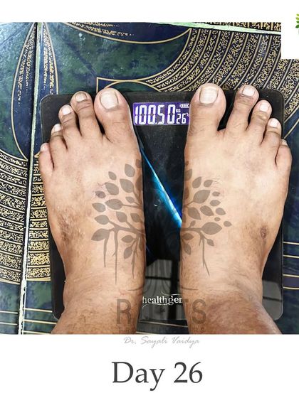 Day 26, and the progress continues. This steady loss shows the body is adapting to a healthier metabolic state, which is crucial for long-term success.