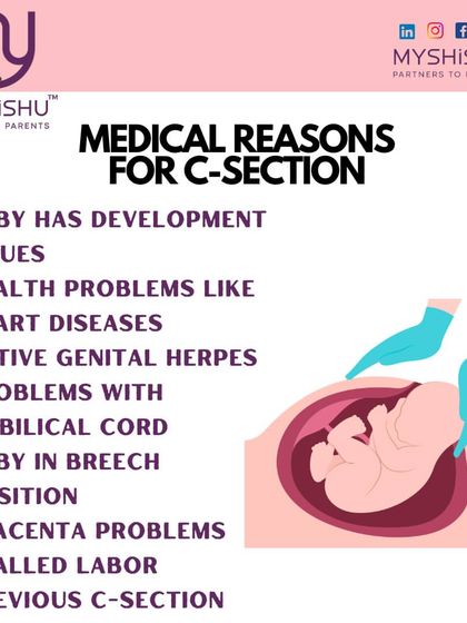 It's important to understand the medical reasons that might necessitate a C-section. This infographic lists conditions like breech position or placenta problems, helping you make informed birthing choices.