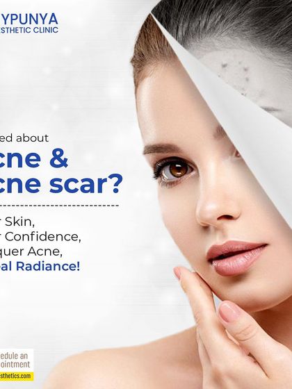 Worried about acne and the scars it leaves behind? With a clear plan, we can achieve clear skin and clear confidence. Let's conquer acne and reveal your natural radiance.