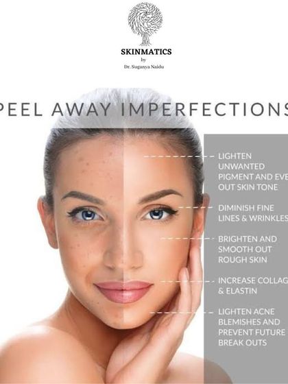 Skinmatics - Facial Aesthetics & Anti-Aging Laser & Peel Treatments photo 4