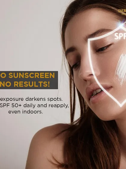 No sunscreen, no results. This visual emphasizes that sun exposure darkens spots and that daily SPF 50+ is essential, even indoors.