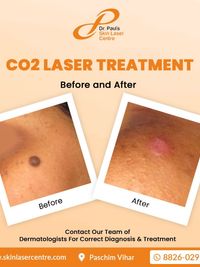 General & Procedural Dermatology