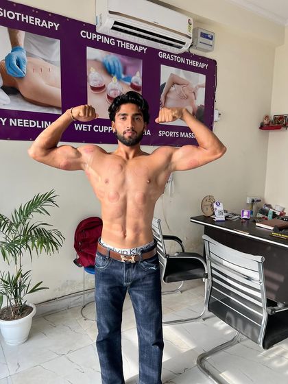 A client showing off his physique in the clinic after his treatment.