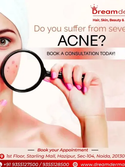 If you suffer from severe or persistent acne, a professional consultation is essential. We use diagnostic tools to look closer at your skin and determine the most effective course of action for you.