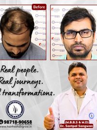Non-Surgical Hair Loss Treatments