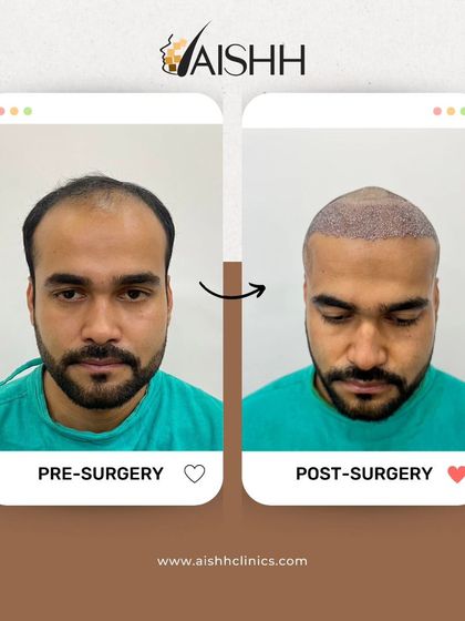 This image shows the immediate post-surgery result compared to the pre-surgery state. It helps patients understand what to expect right after the procedure.