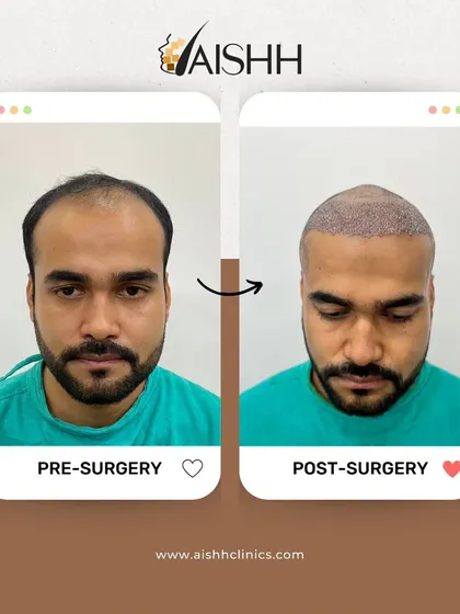 This image shows the immediate post-surgery result compared to the pre-surgery state. It helps patients understand what to expect right after the procedure.