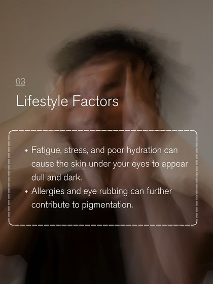 Lifestyle factors like fatigue, stress, and poor hydration can cause the skin under your eyes to appear dull and dark. Allergies and eye rubbing also contribute to pigmentation.