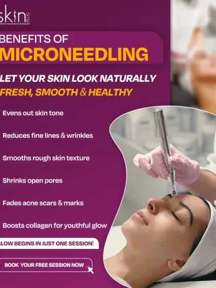 This graphic clearly outlines the multiple benefits of microneedling. It serves as a quick, informative guide for clients, covering everything from evening out skin tone and reducing wrinkles to shrinking pores and fading acne scars.