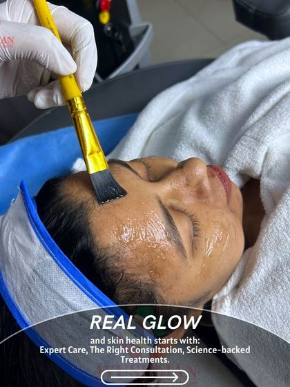 Real glow starts with science-backed treatments. Here, a client receives a professional chemical peel application, a key service we offer for skin health, exfoliation, and achieving a luminous complexion.