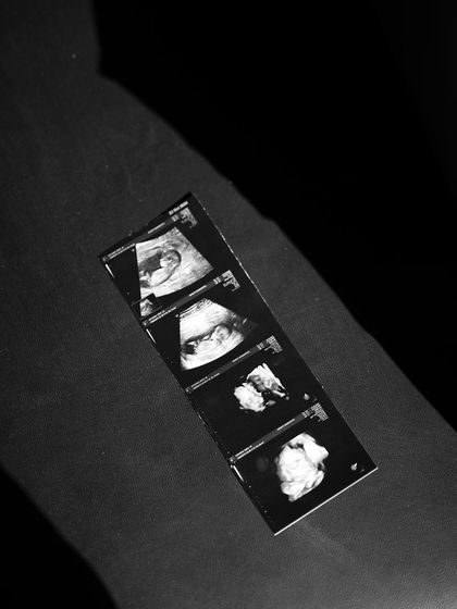 A simple, powerful black and white close-up of the sonogram pictures. This minimalist shot puts the focus entirely on the first glimpse of their baby.