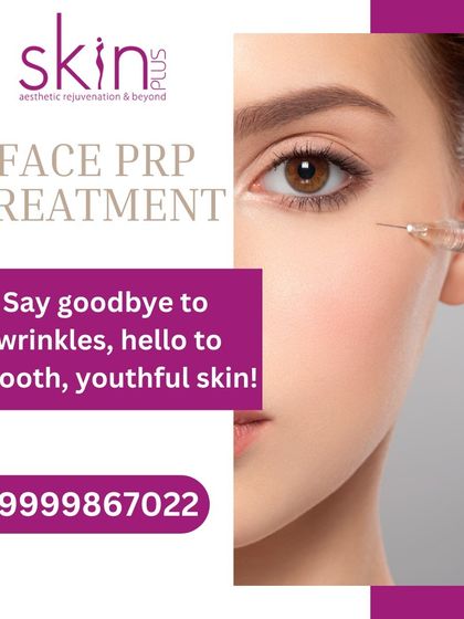 Collagen Boosting: Microneedling & PRP photo 15