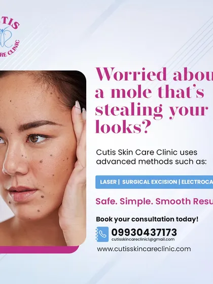 If you're worried about a mole on your face, we offer advanced removal methods like laser, surgical excision, and electrocautery. These procedures provide safe, simple, and smooth results for clear, confident skin.