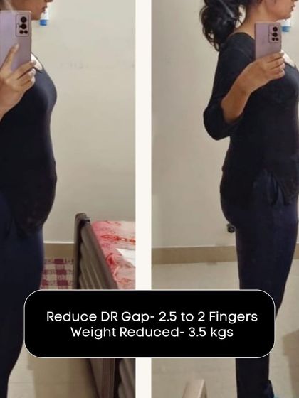 This client reduced her DR gap from 2.5 to 2 fingers and lost 3.5kg, showing steady and sustainable progress.