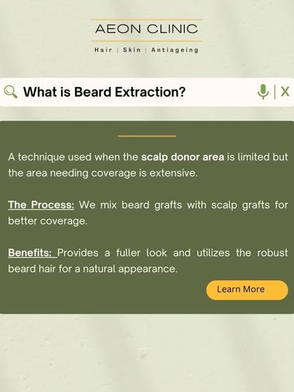 What is beard extraction? It's a technique where we use robust beard hair as a donor source for scalp transplants, which is especially useful when scalp donor hair is limited.