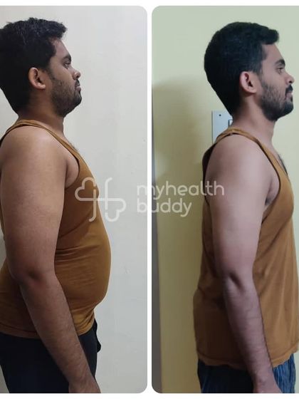 Another side profile of Gowtham's incredible 6-month transformation.