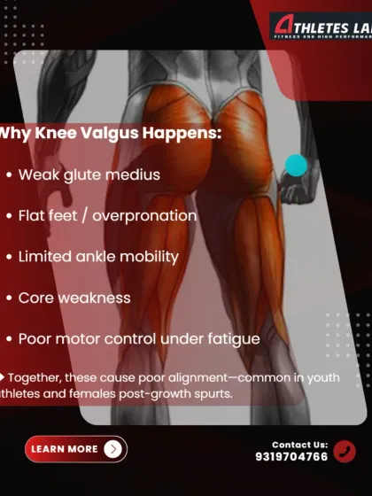 We explain the common causes of knee valgus, which include weak gluteus medius muscles, limited ankle mobility, and poor motor control. These factors are particularly common in youth athletes and post-growth spurt females.