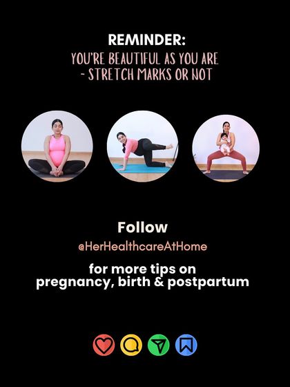 This is your reminder that you are beautiful just as you are, with or without stretch marks. Follow me for more tips on pregnancy, birth, and postpartum.