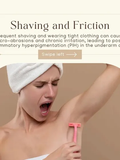 Shaving and friction from tight clothing can cause micro-abrasions and chronic irritation. This leads to something called post-inflammatory hyperpigmentation (PIH), a common cause of dark underarms.